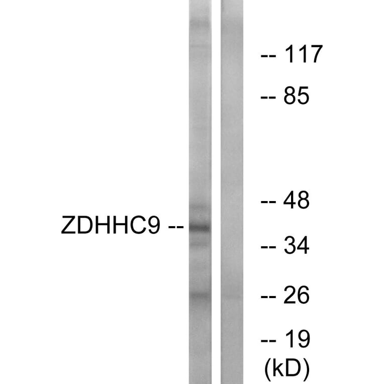 Western Blot - Anti-ZDHHC9 Antibody (C17600) - Antibodies.com