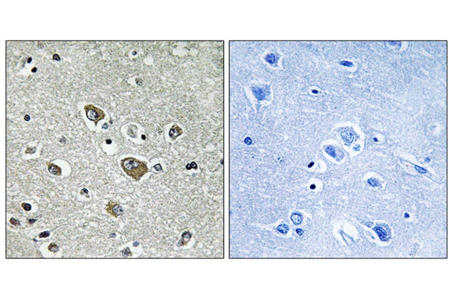 Immunohistochemistry - Anti-ZDHHC9 Antibody (C17600) - Antibodies.com