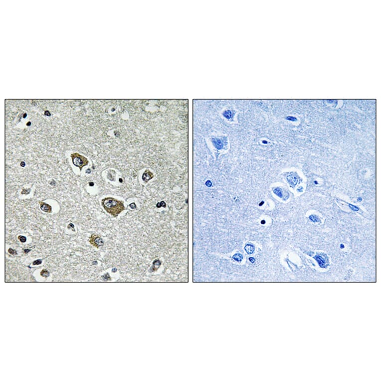 Immunohistochemistry - Anti-ZDHHC9 Antibody (C17600) - Antibodies.com