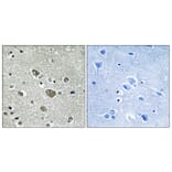 Immunohistochemistry - Anti-ZDHHC9 Antibody (C17600) - Antibodies.com