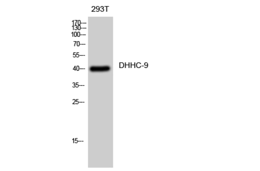 Western Blot - Anti-ZDHHC9 Antibody (C17600) - Antibodies.com