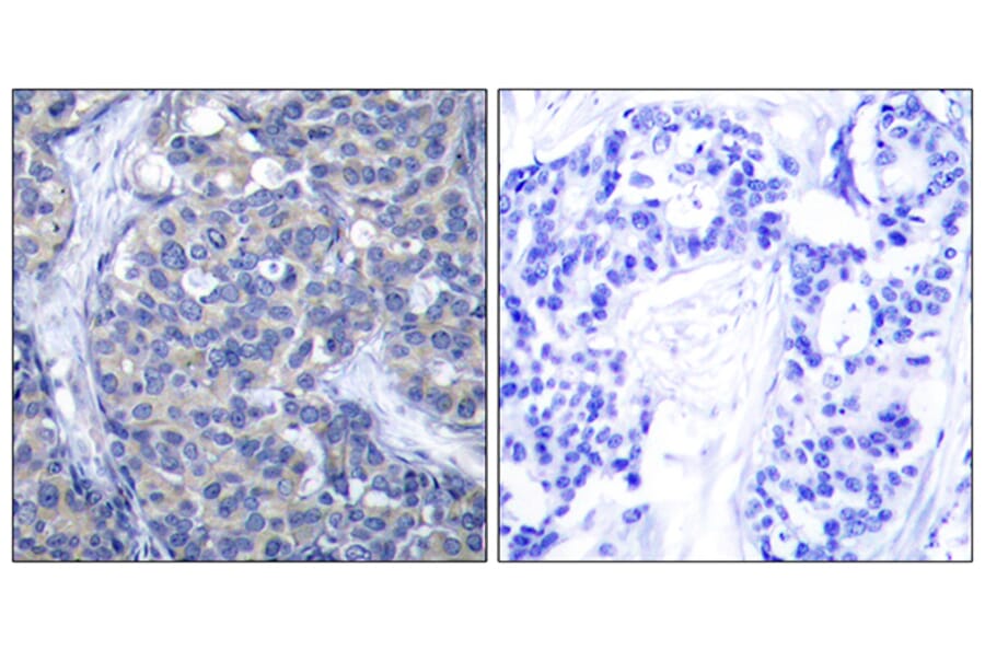 Immunohistochemistry - Anti-ZAP-70 Antibody (B7255) - Antibodies.com