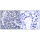 Immunohistochemistry - Anti-ZAP-70 Antibody (B7255) - Antibodies.com