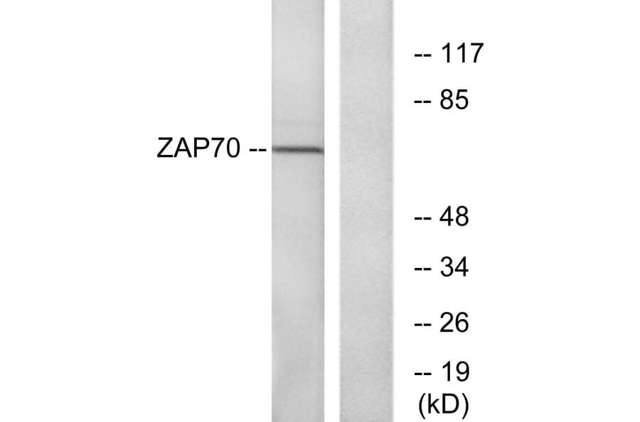 Western Blot - Anti-ZAP-70 Antibody (B7255) - Antibodies.com