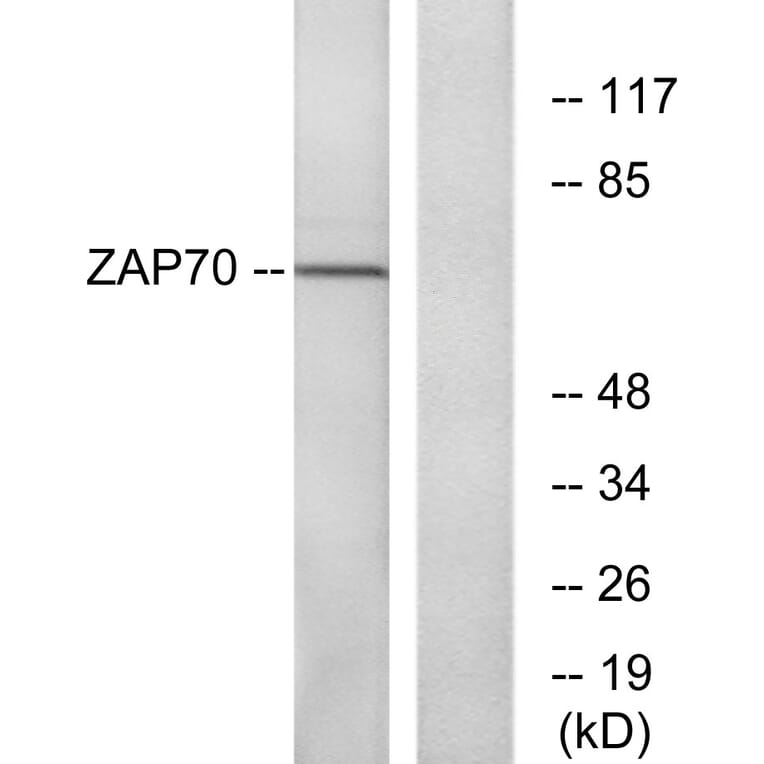 Western Blot - Anti-ZAP-70 Antibody (B7255) - Antibodies.com