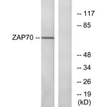 Western Blot - Anti-ZAP-70 Antibody (B7255) - Antibodies.com