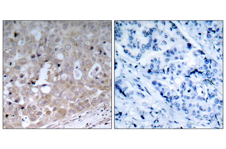 Immunohistochemistry - Anti-VEGFR2 Antibody (B7252) - Antibodies.com