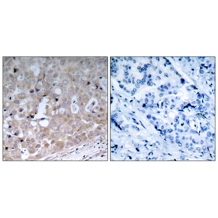 Immunohistochemistry - Anti-VEGFR2 Antibody (B7252) - Antibodies.com