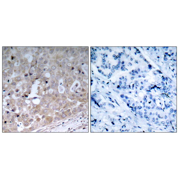Immunohistochemistry - Anti-VEGFR2 Antibody (B7252) - Antibodies.com