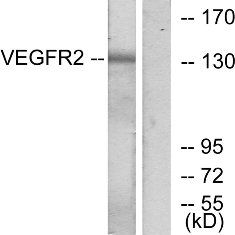 Western Blot - Anti-VEGFR2 Antibody (B7252) - Antibodies.com