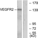 Western Blot - Anti-VEGFR2 Antibody (B7252) - Antibodies.com