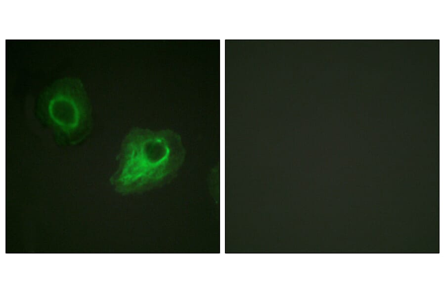 Immunofluorescence - Anti-VEGFR2 Antibody (B1014) - Antibodies.com