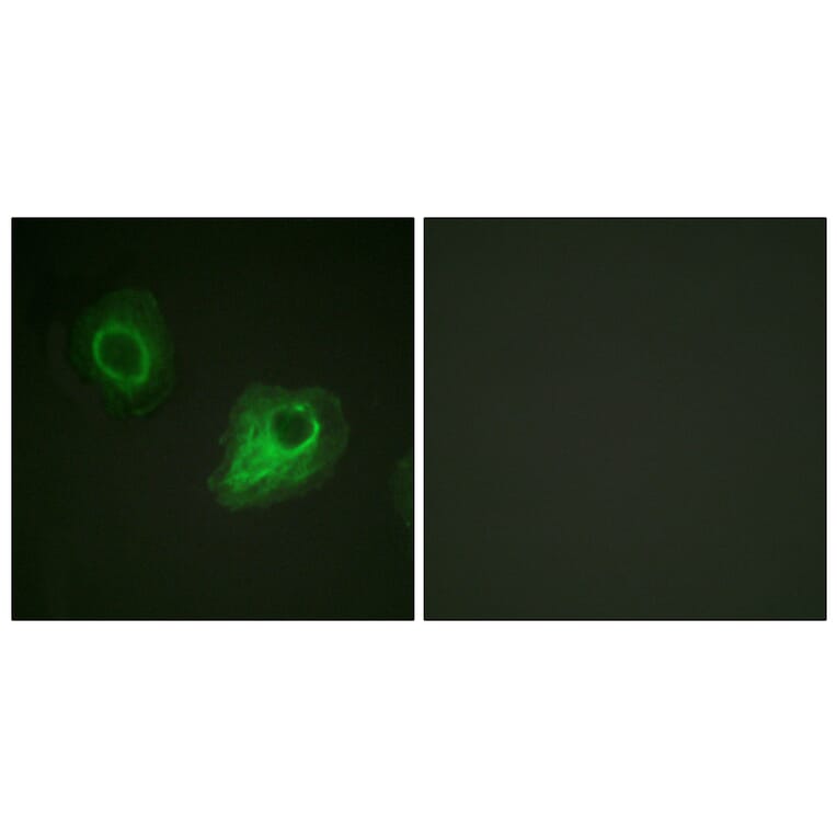 Immunofluorescence - Anti-VEGFR2 Antibody (B1014) - Antibodies.com