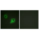 Immunofluorescence - Anti-VEGFR2 Antibody (B1014) - Antibodies.com