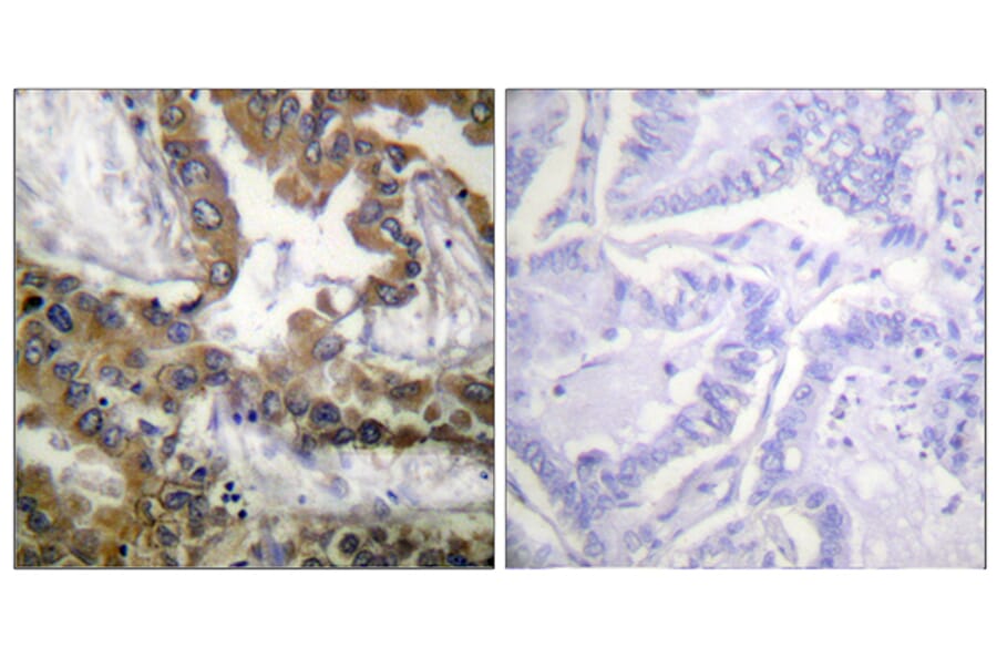 Immunohistochemistry - Anti-VEGFR2 Antibody (B1014) - Antibodies.com