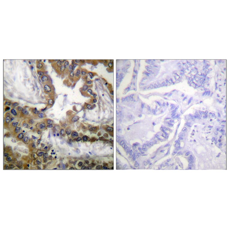 Immunohistochemistry - Anti-VEGFR2 Antibody (B1014) - Antibodies.com