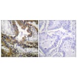 Immunohistochemistry - Anti-VEGFR2 Antibody (B1014) - Antibodies.com