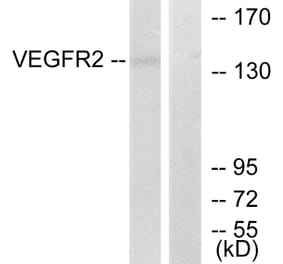 Western Blot - Anti-VEGFR2 Antibody (B7253) - Antibodies.com