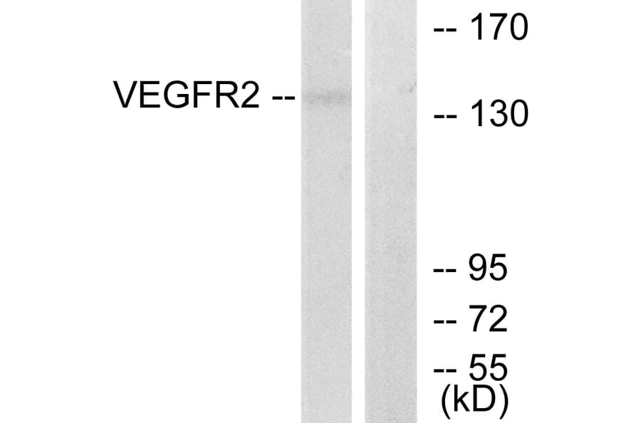 Western Blot - Anti-VEGFR2 Antibody (B7253) - Antibodies.com
