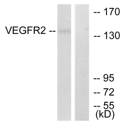 Western Blot - Anti-VEGFR2 Antibody (B7253) - Antibodies.com