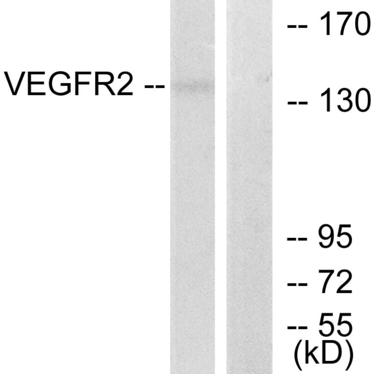 Western Blot - Anti-VEGFR2 Antibody (B7253) - Antibodies.com
