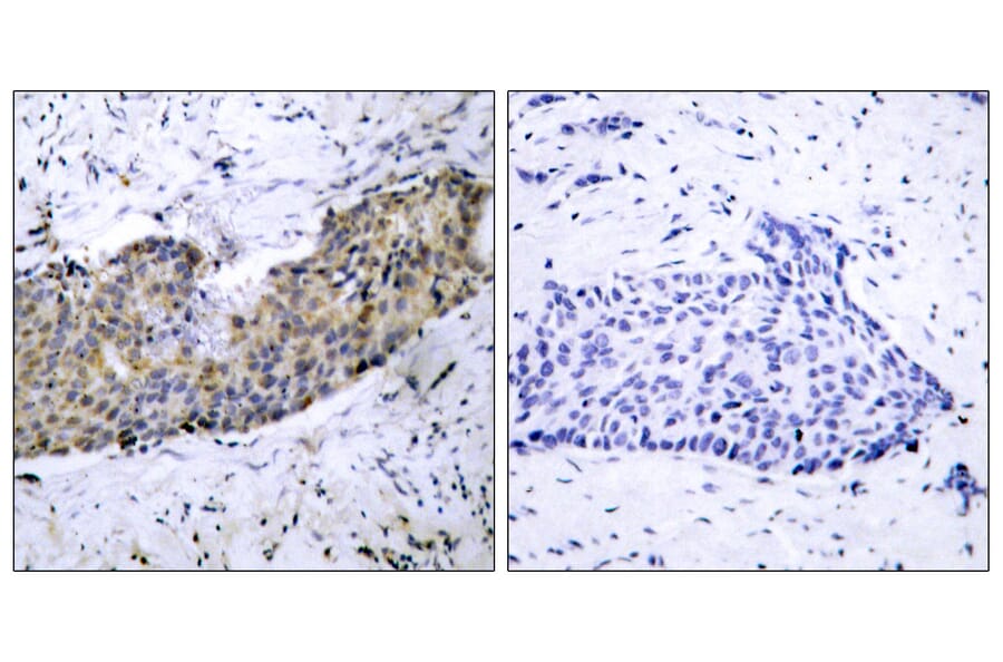 Immunohistochemistry - Anti-VEGFR2 Antibody (B7253) - Antibodies.com