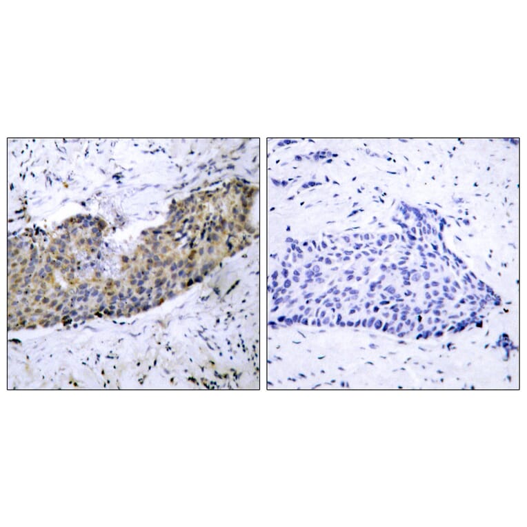Immunohistochemistry - Anti-VEGFR2 Antibody (B7253) - Antibodies.com
