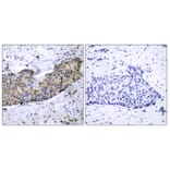 Immunohistochemistry - Anti-VEGFR2 Antibody (B7253) - Antibodies.com