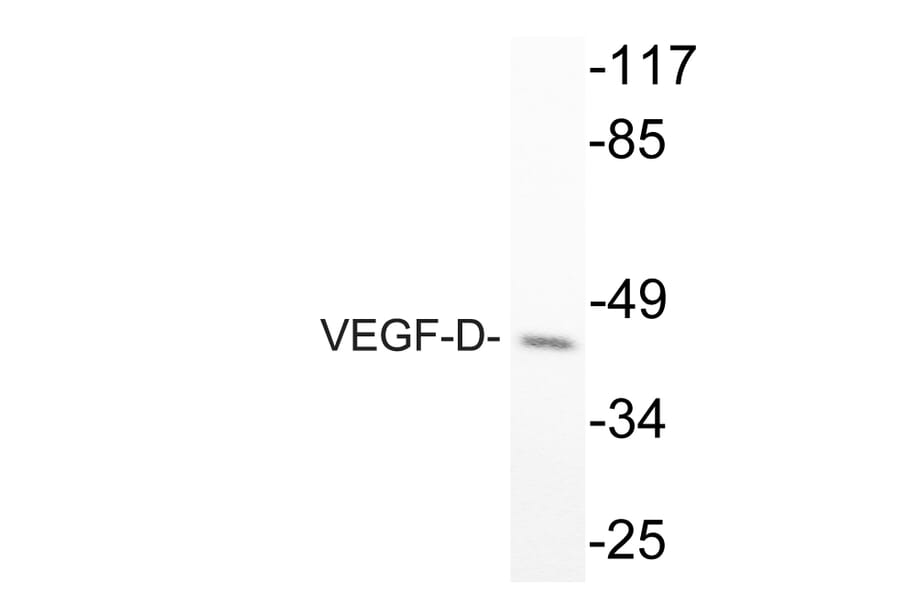 Western Blot - Anti-VEGF-D Antibody (R12-2408) - Antibodies.com