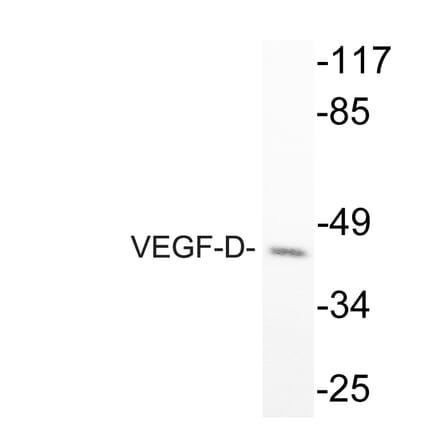 Western Blot - Anti-VEGF-D Antibody (R12-2408) - Antibodies.com
