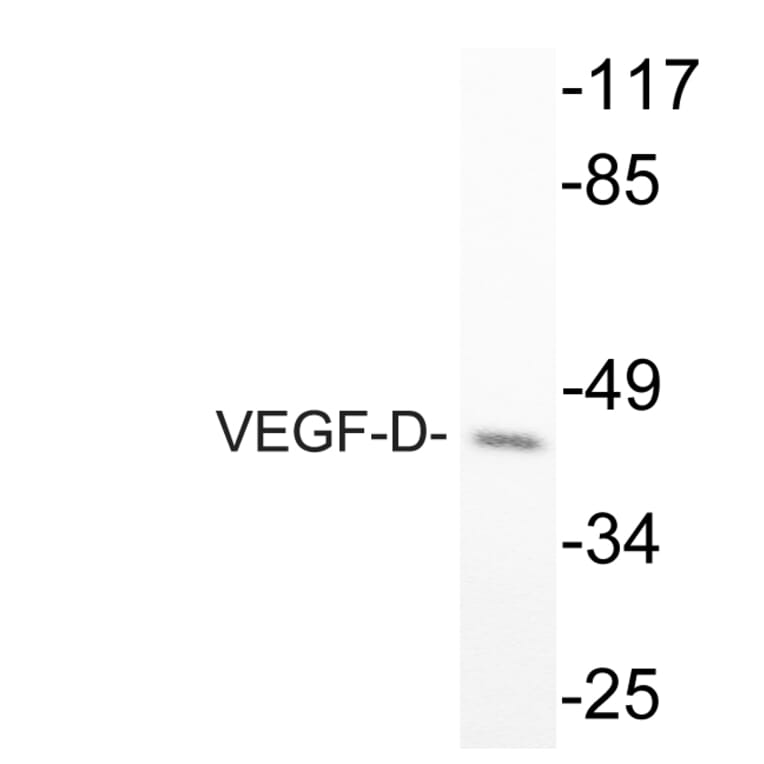 Western Blot - Anti-VEGF-D Antibody (R12-2408) - Antibodies.com