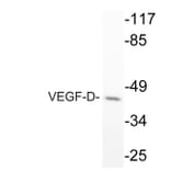 Western Blot - Anti-VEGF-D Antibody (R12-2408) - Antibodies.com