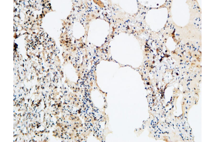 Immunohistochemistry - Anti-VEGF-D Antibody (R12-2408) - Antibodies.com