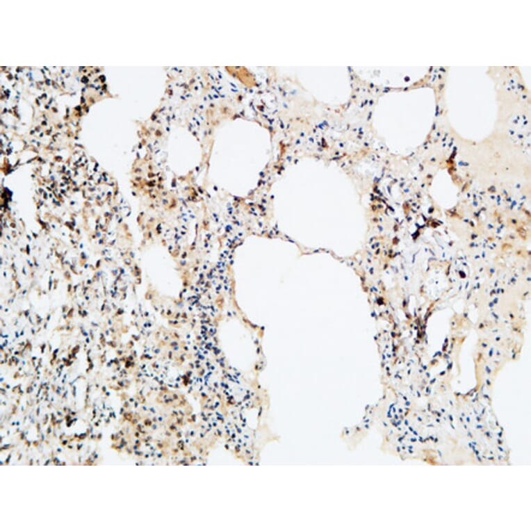 Immunohistochemistry - Anti-VEGF-D Antibody (R12-2408) - Antibodies.com