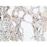 Immunohistochemistry - Anti-VEGF-D Antibody (R12-2408) - Antibodies.com