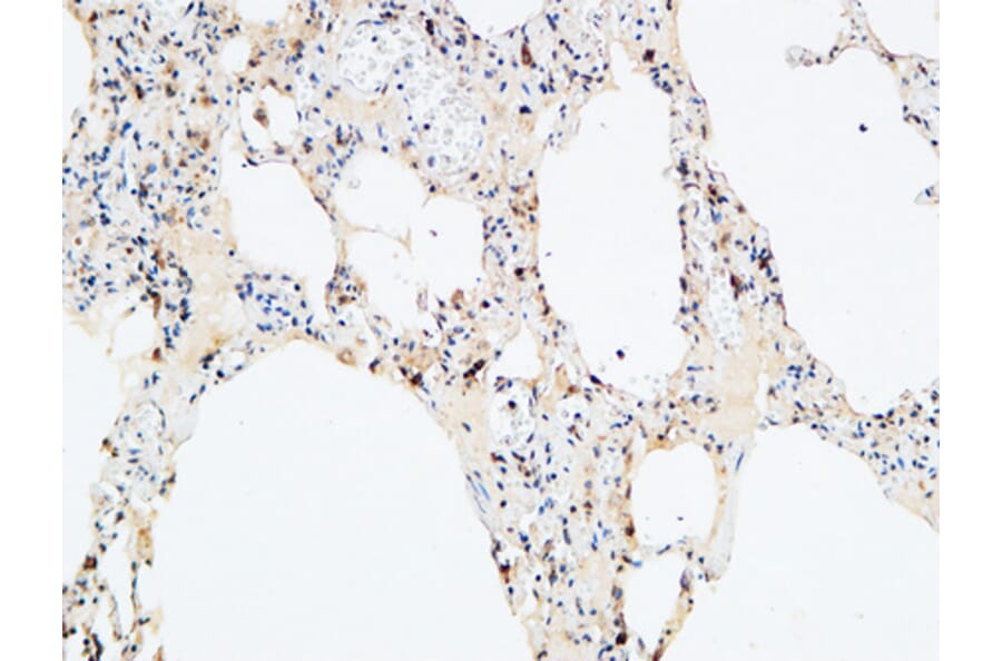 Immunohistochemistry - Anti-VEGF-D Antibody (R12-2408) - Antibodies.com