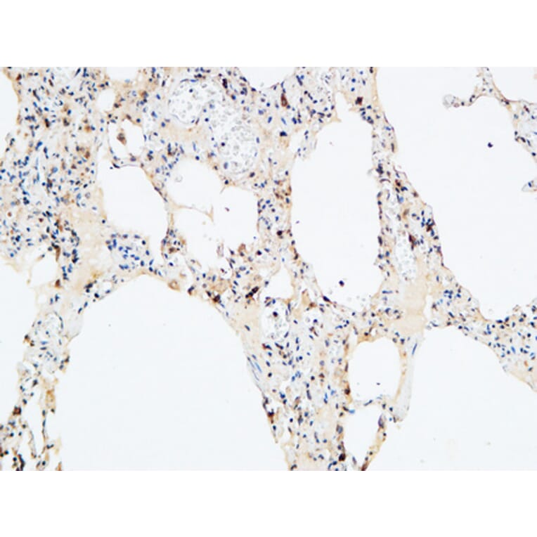 Immunohistochemistry - Anti-VEGF-D Antibody (R12-2408) - Antibodies.com