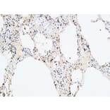 Immunohistochemistry - Anti-VEGF-D Antibody (R12-2408) - Antibodies.com