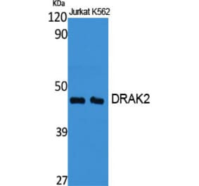 Western Blot - Anti-STK17B Antibody (C21136) - Antibodies.com