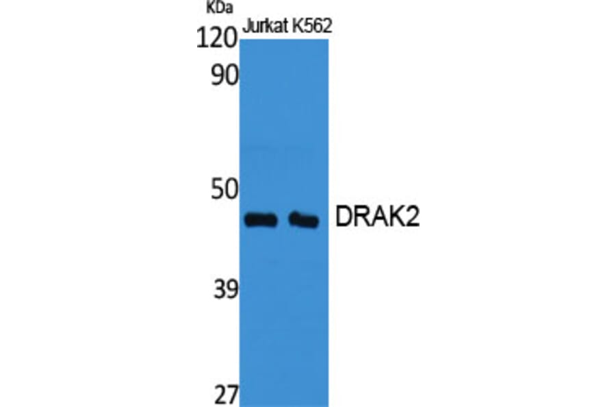 Western Blot - Anti-STK17B Antibody (C21136) - Antibodies.com