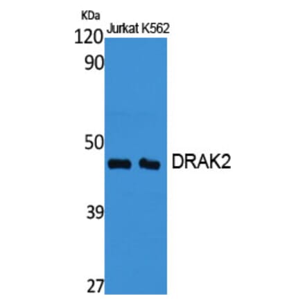 Western Blot - Anti-STK17B Antibody (C21136) - Antibodies.com