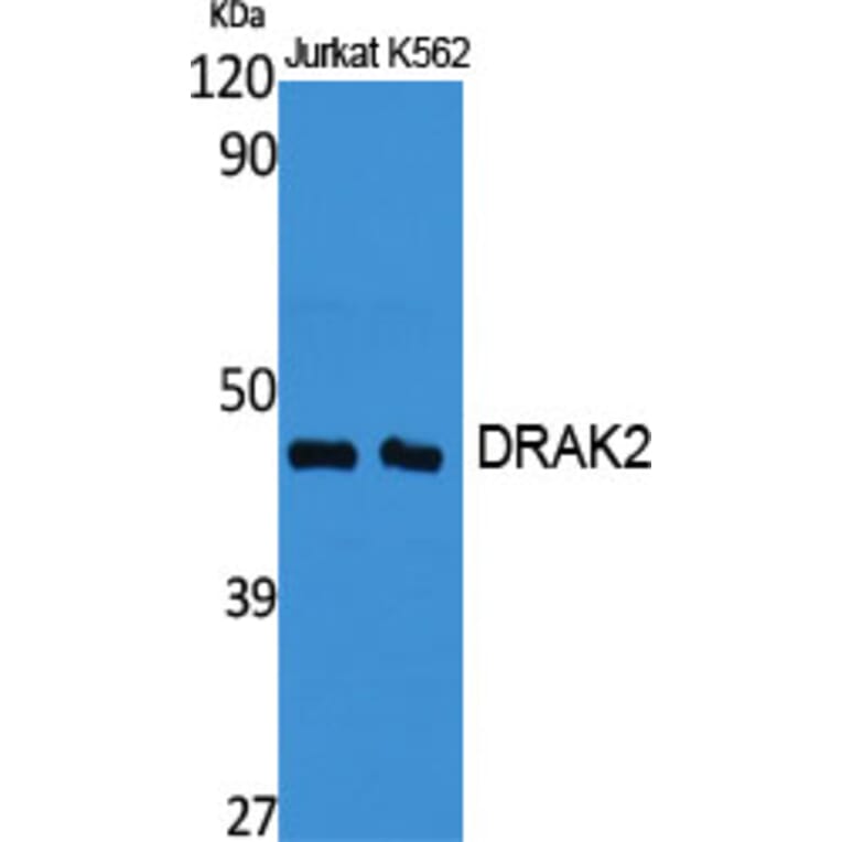 Western Blot - Anti-STK17B Antibody (C21136) - Antibodies.com