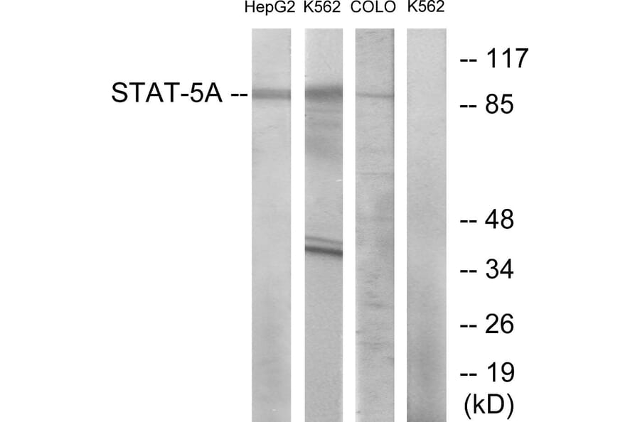 Western Blot - Anti-STAT5A Antibody (B7227) - Antibodies.com