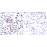 Immunohistochemistry - Anti-STAT5A Antibody (B7227) - Antibodies.com