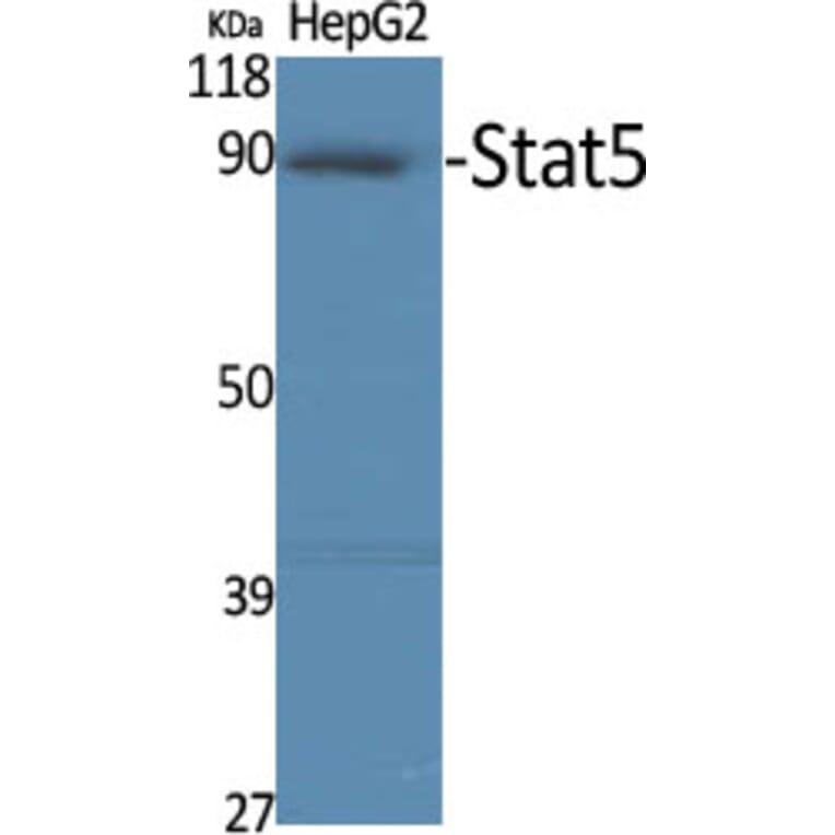 Western Blot - Anti-STAT5A Antibody (B7227) - Antibodies.com