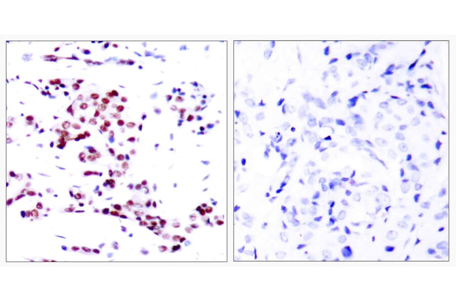 Immunohistochemistry - Anti-STAT5A Antibody (B7226) - Antibodies.com