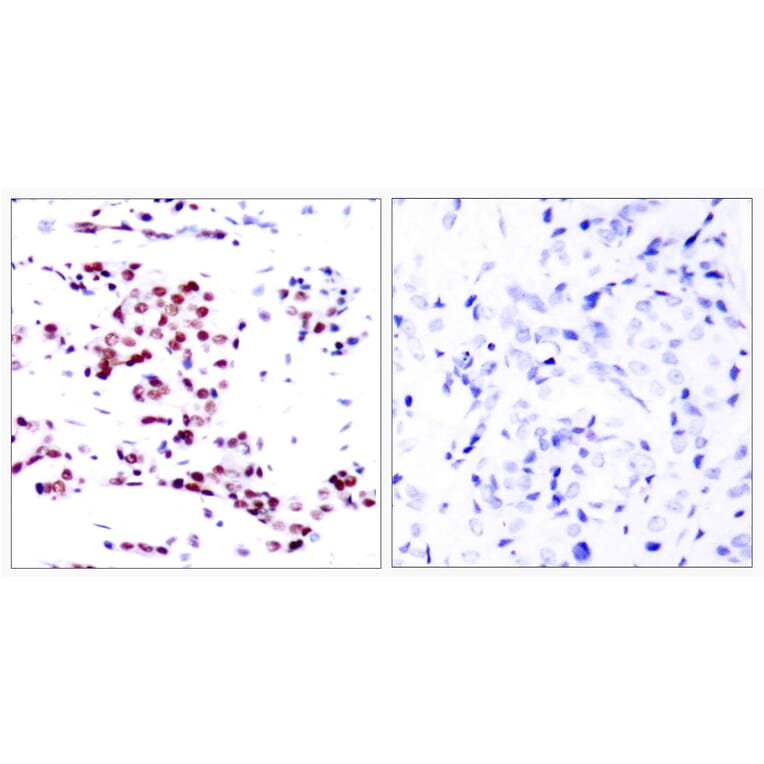 Immunohistochemistry - Anti-STAT5A Antibody (B7226) - Antibodies.com