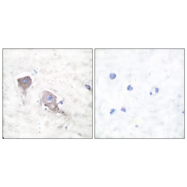 Immunohistochemistry - Anti-SNAP25 Antibody (C0326) - Antibodies.com