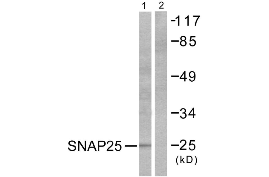 Western Blot - Anti-SNAP25 Antibody (C0326) - Antibodies.com