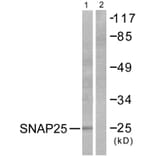 Western Blot - Anti-SNAP25 Antibody (C0326) - Antibodies.com